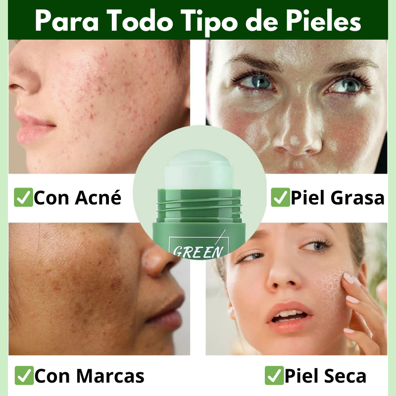 MagicMask® - Mascarilla Facial Anti-Imperfecciones de Té Verde - ¡1+1 GRATIS!